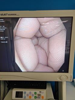 Olympus CF-H190I Colonoscope - 12