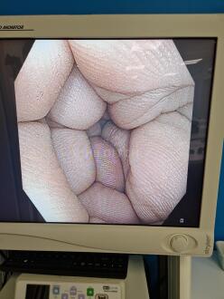 Olympus CF-H190I Colonoscope - 14