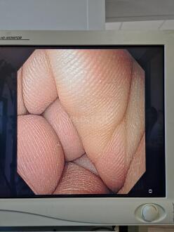 GIF-Q160 Gastroscope - 13
