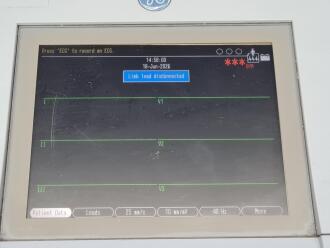 GE MAC 3500 ECG Recorder on Trolley - 3