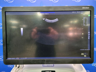 GE Logiq E9 Ultrasound - 6