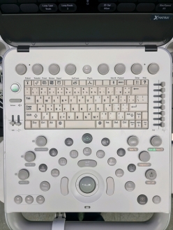 Philips CX50 Portable Ultrasound on Philips CX Trolley - 4