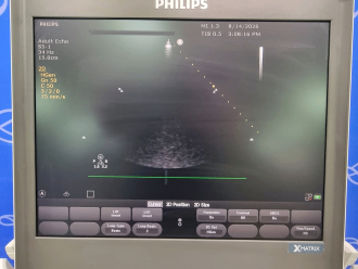Philips CX50 Portable Ultrasound on Philips CX Trolley - 5