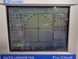 Keeler Pro-Check Auto Lensmeter - 2