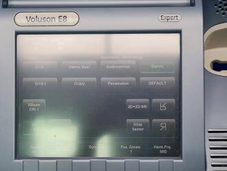 GE Voluson E8 Ultrasound - 5