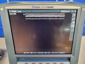 Sonosite MicroMaxx Portable Ultrasound - 6