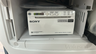 GE Voluson E8 BT20 Ultrasound System - 13
