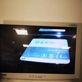 Vims VSX8000-4K Video Laparoscope - 4