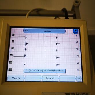Fukuda Denshi FX-8322 Electrocardiograph - 7