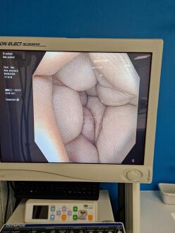 Olympus CF-H190I Colonoscope - 11