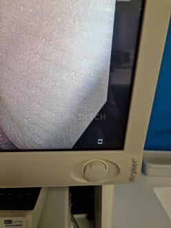 Olympus CF-H190I Colonoscope - 12