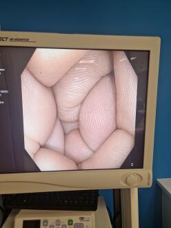 Olympus CF-H190I Colonoscope - 9