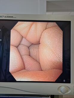 GIF-Q160 Gastroscope - 12