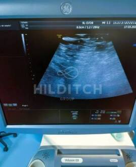 GE Voluson E8 Expert Ultrasound - 5