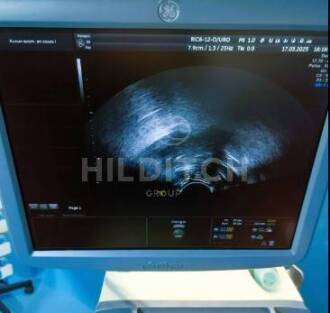 GE Voluson E8 Expert Ultrasound - 6