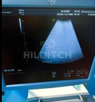 GE Voluson E8 Expert Ultrasound - 7