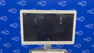 Siemens Healthineers Acuson Sequoia Ultrasound System - 4