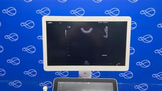 Siemens Healthineers Acuson Sequoia Ultrasound System - 4