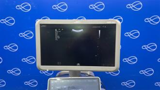 Siemens Healthineers Acuson Juniper Ultrasound System - 4