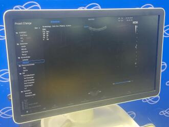 Samsung HERA W10 Ultrasound - 2