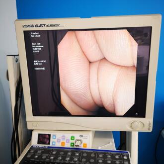 Olympus TJF-Q180V Videoduodenoscope - 11