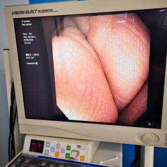 Olympus CF-Q180AL Colonoscope - 6