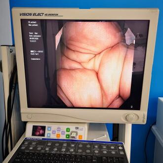 Olympus CF-Q180AL Colonoscope - 8