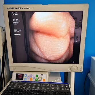 Olympus CF-Q180AL Colonoscope - 12