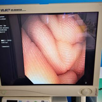 Olympus CF-Q180AL Colonoscope - 12