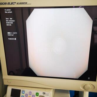 Olympus CF-Q180AL Colonoscope - 7