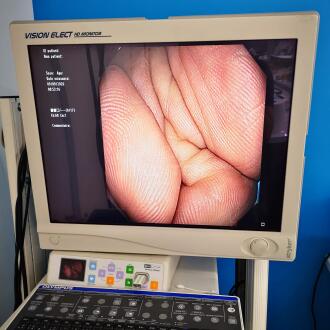 Olympus CF-Q180AL Colonoscope - 10