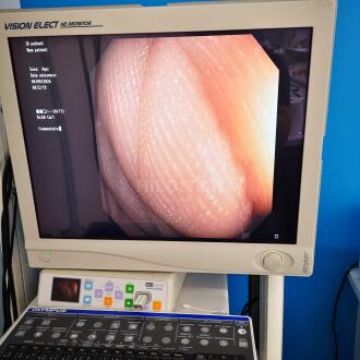 Olympus CF-Q180AL Colonoscope - 12