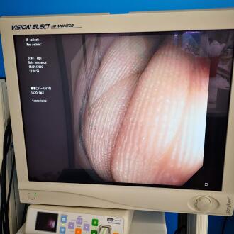 Olympus CF-Q180AL Colonoscope - 8