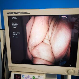 Olympus CF-Q180AL Colonoscope - 9