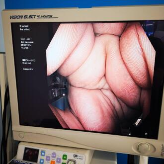 Olympus CF-H180AL Colonoscope - 11