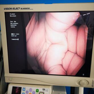 Olympus CF-H180AL Colonscope - 10