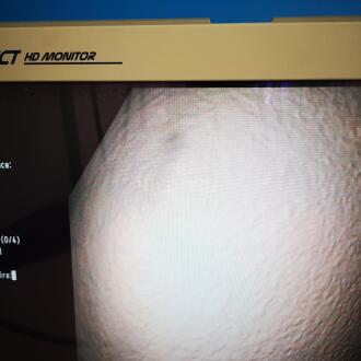Olympus CF-H180AL Colonscope - 12