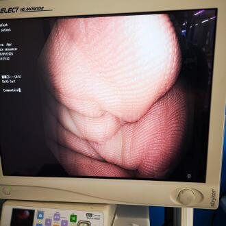 Olympus CF-H180AL Colonscope - 13