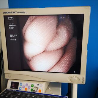 Olympus CF-H180AL Colonoscope - 13