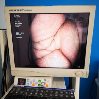 Olympus CF-H180AL Colonoscope - 16