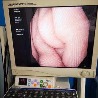Olympus GIF-H180 Gastroscope - 11