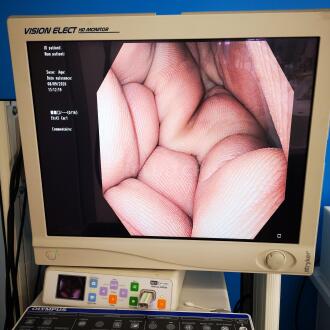 Olympus GIF-H180 Gastroscope - 12