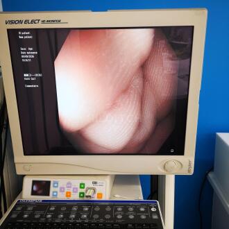 Olympus CF-H180AL Colonoscope - 9