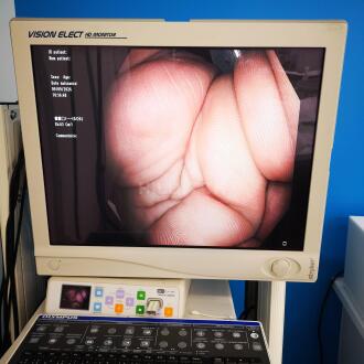 Olympus CF-H180AL Colonoscope - 11