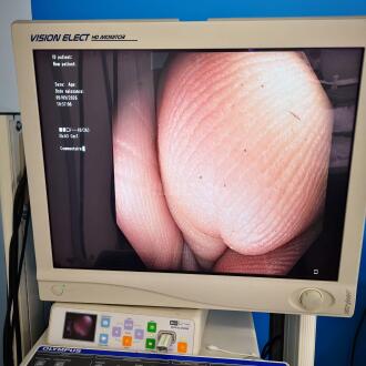 Olympus CF-H180AL Colonoscope - 13