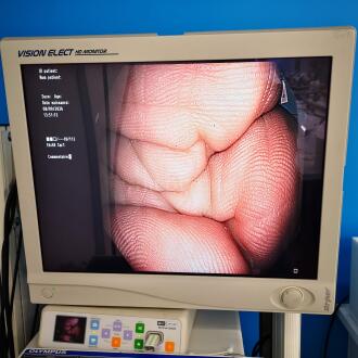 Olympus CF-H180AL Colonoscope - 9