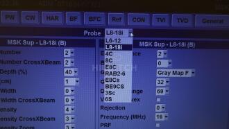Logiq F6 Ultrasound - 6