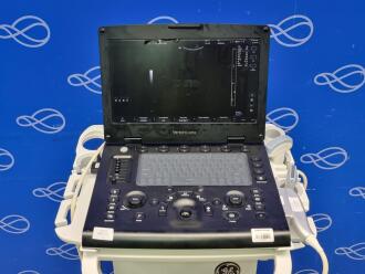 GE Versana Active Portable Ultrasound System on GE Cart - No SSD - 2